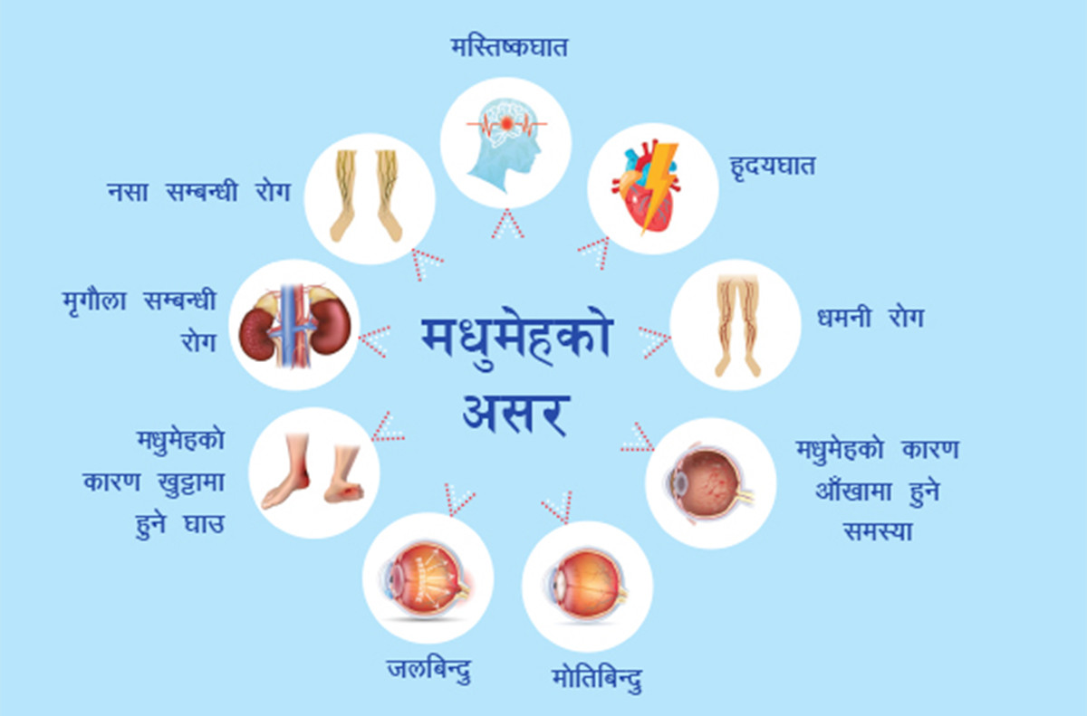 मधुमेह रोगका  यी हुन् लक्षण :  यसबाट जोगिन के खाने के नखाने